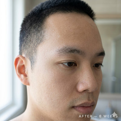 After